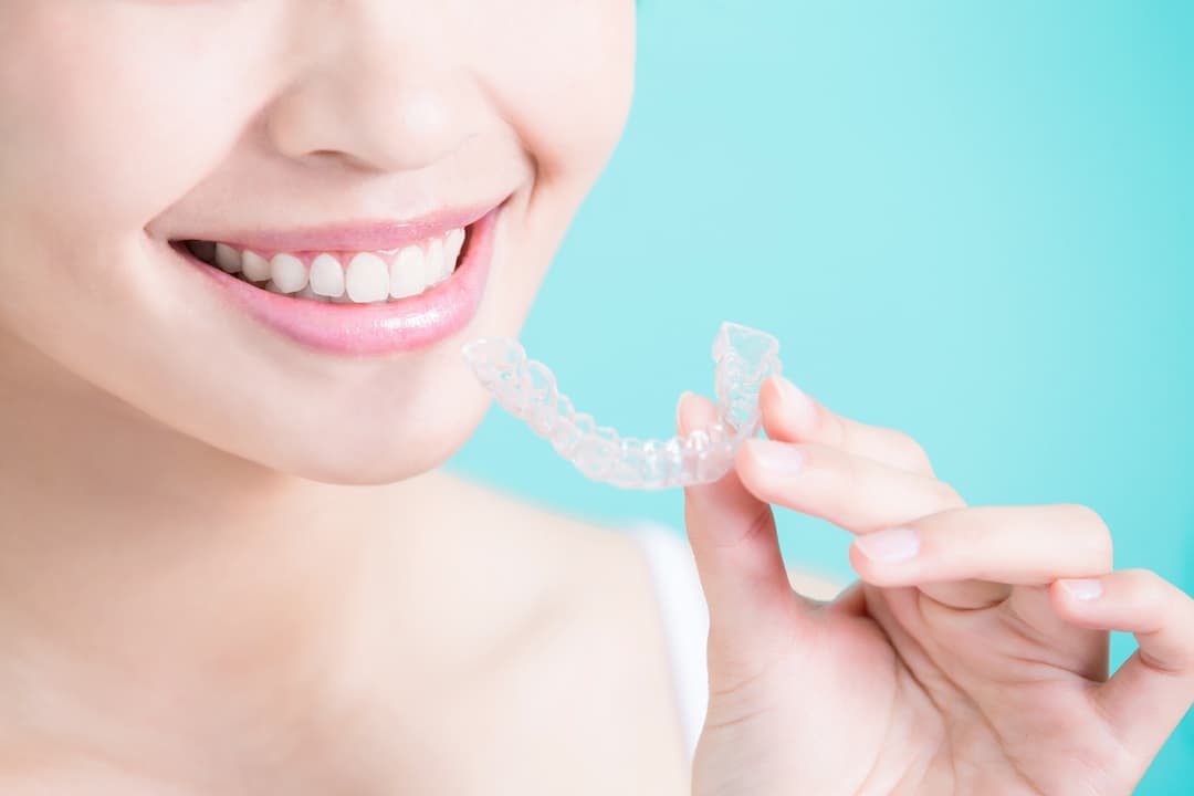 Everything You Need to Know About Invisible Braces