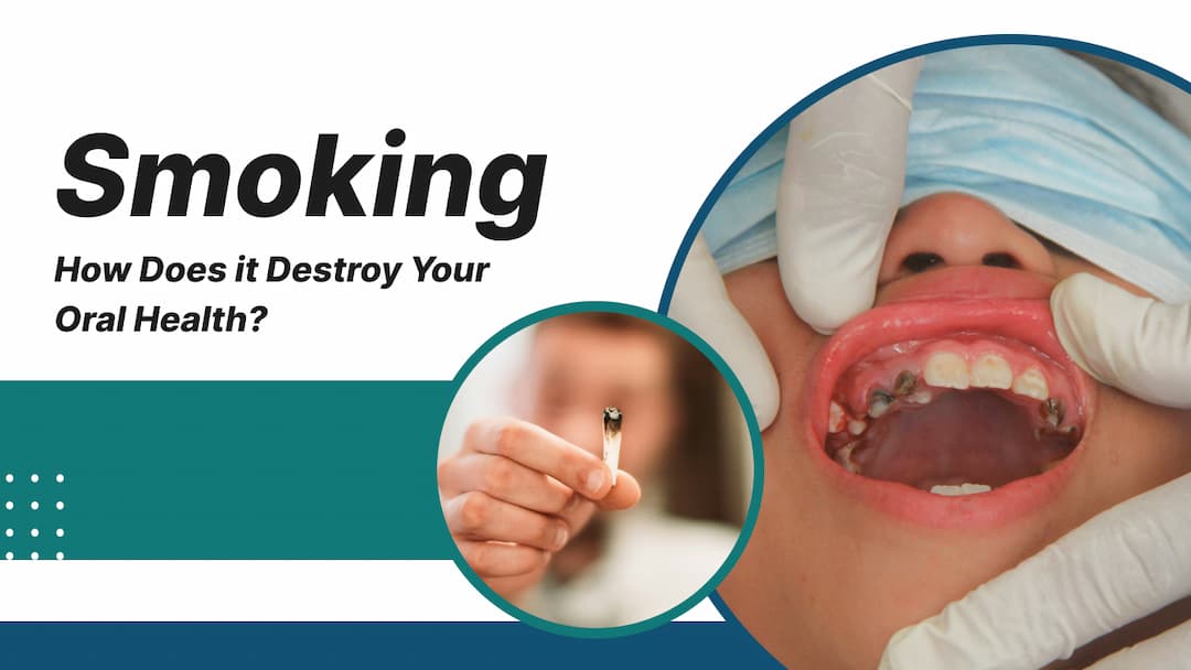 How Smoking Damages Your Teeth, Gums, and Smile
