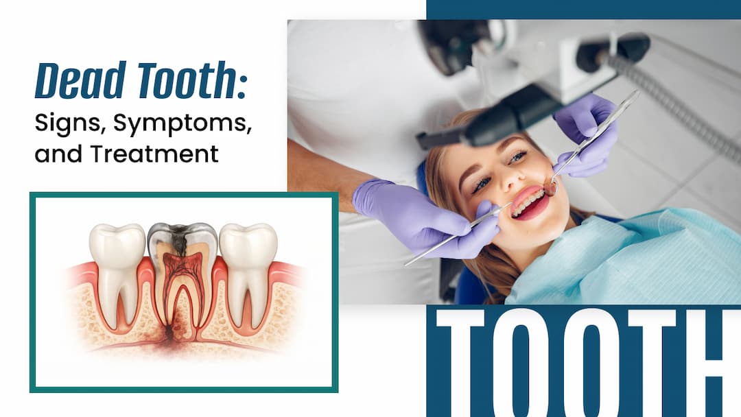 Dead Tooth: Signs, Symptoms, and Treatment | Carrum Downs Dental