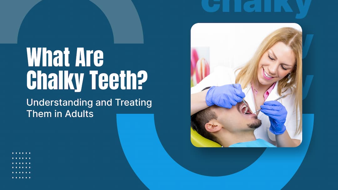 What Are Chalky Teeth? Symptoms & Care Tips